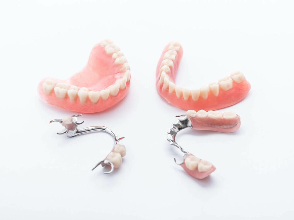 Photo of full and partial dentures.