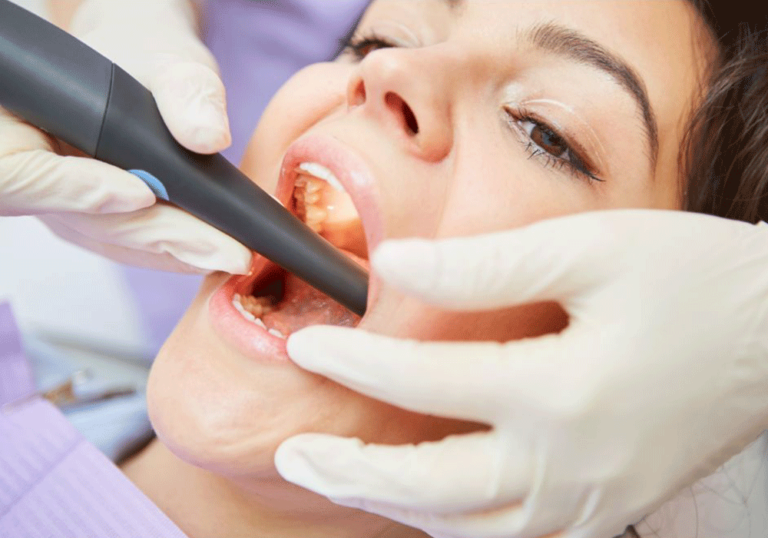 Wide-mouthed patient with an investigative dental appliance placed in the mouth.